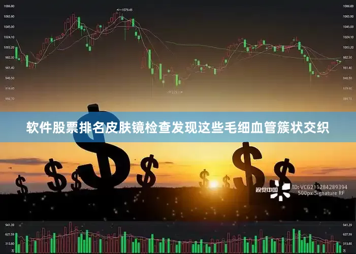 软件股票排名皮肤镜检查发现这些毛细血管簇状交织